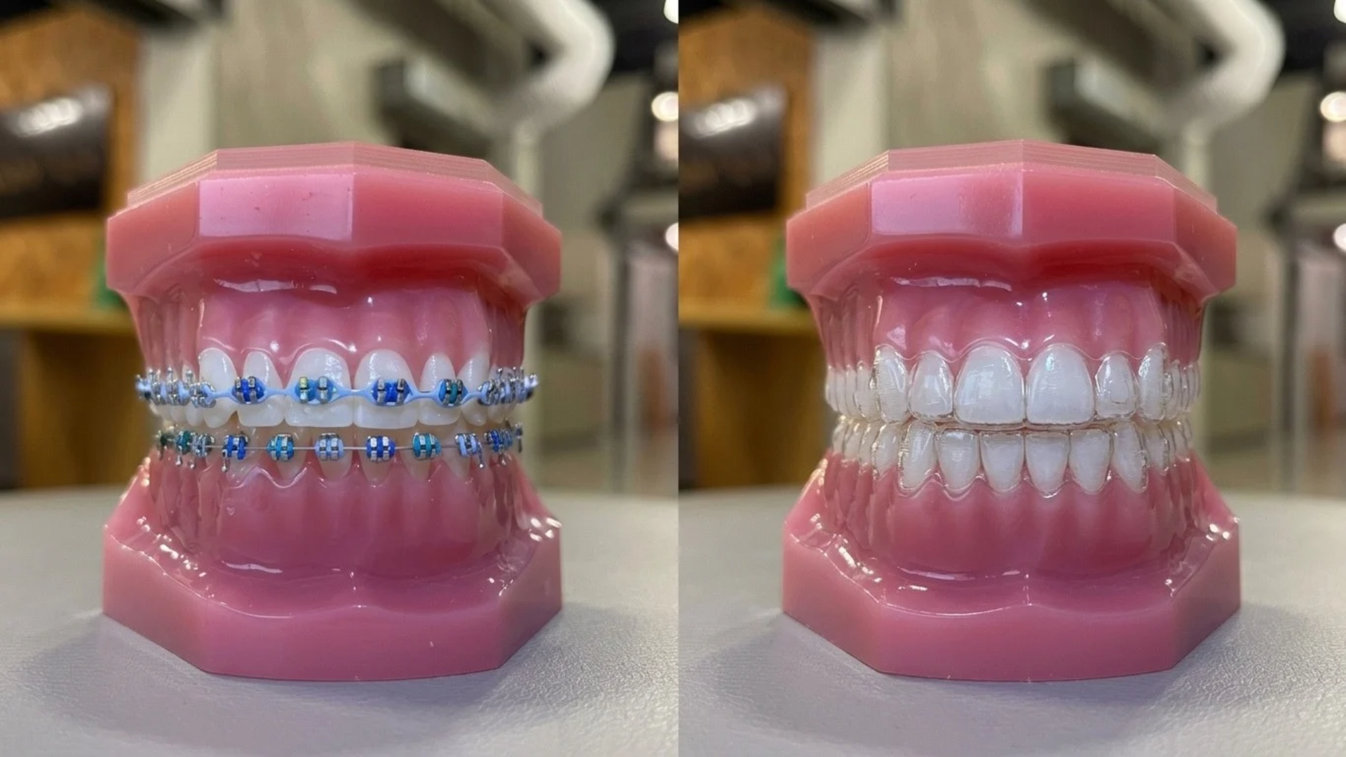 braces vs clear aligners,orthodontist New Albany IN,clear aligners vs braces cost,best orthodontist near me,benefits of braces vs aligners,no referral orthodontist near me